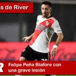 Felipe Peña Biafore con una grave lesión